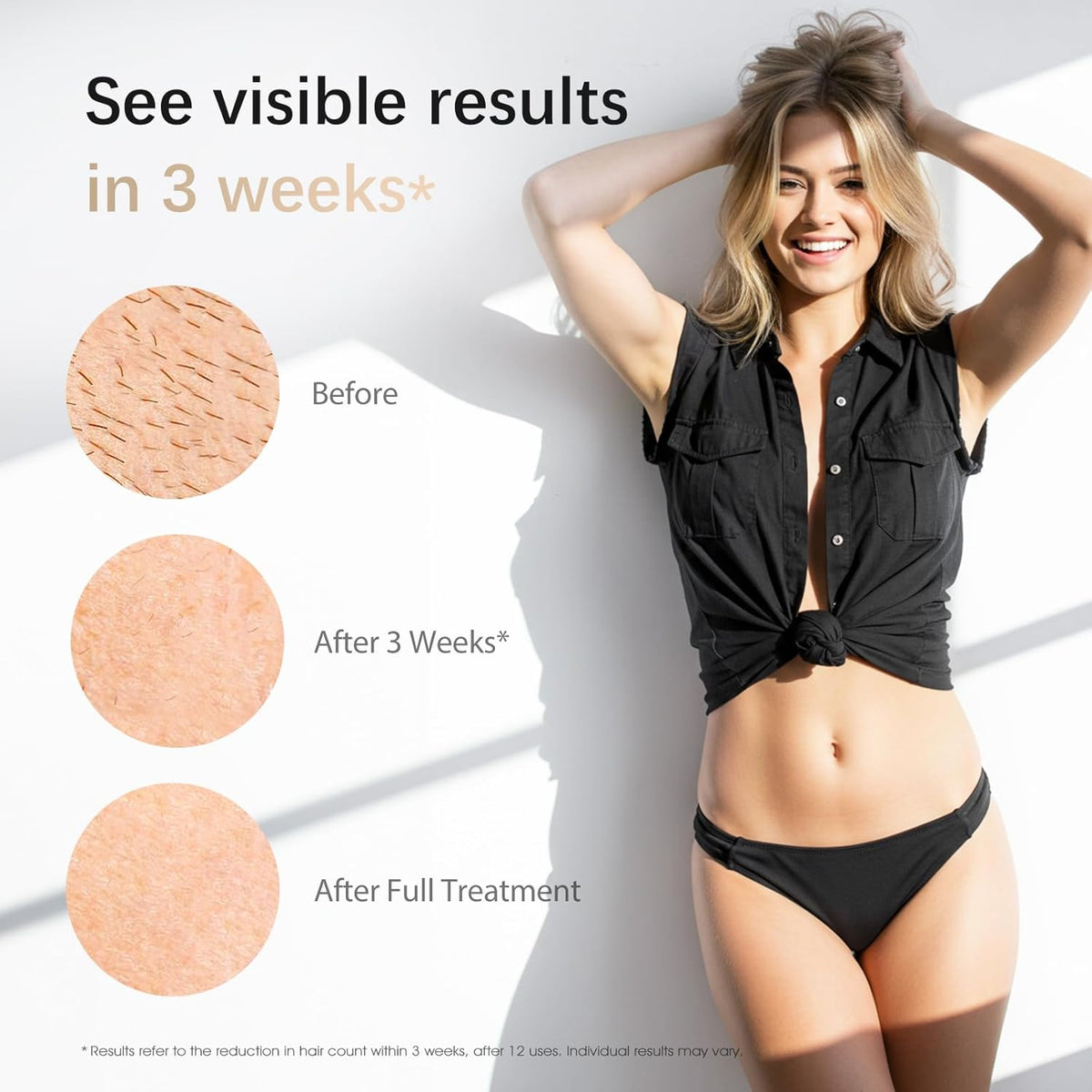 Glowelle™ PureSilk IPL Hair Removal