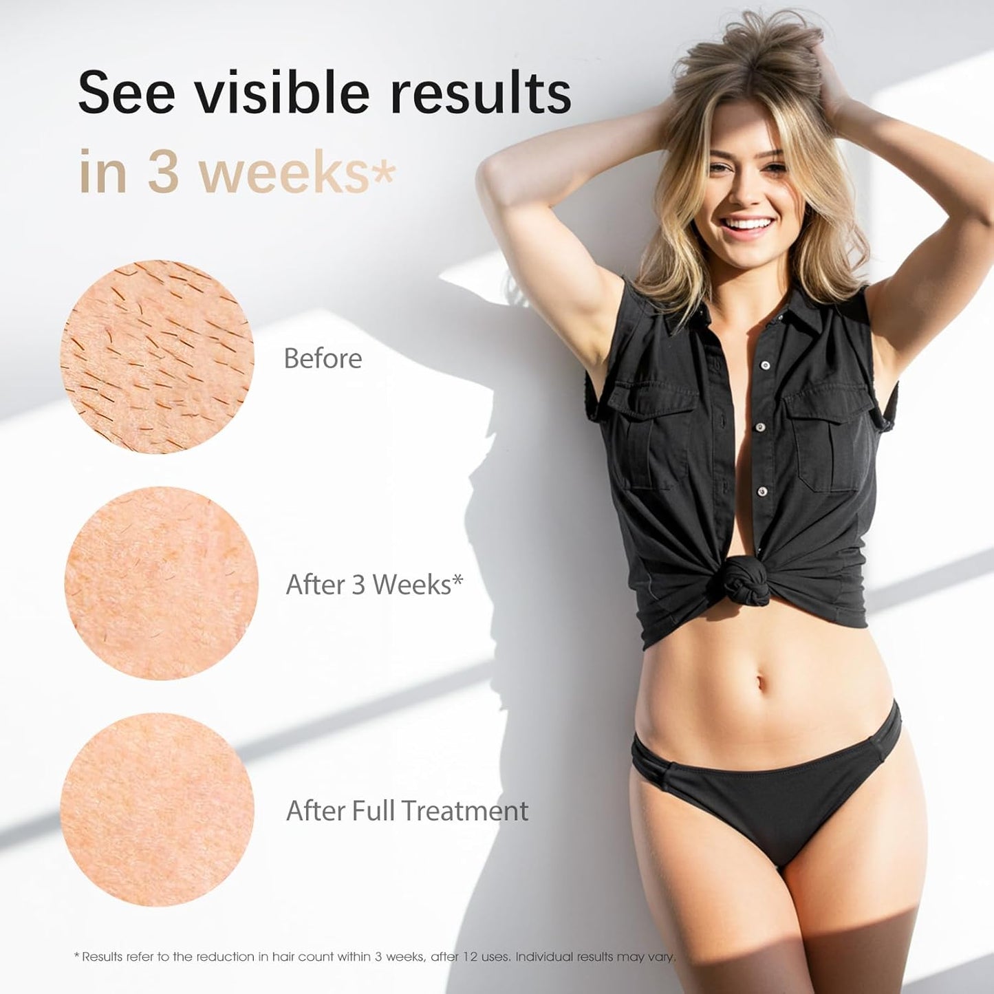 Glowelle™ PureSilk IPL Hair Removal