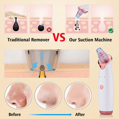 Electric Vacuum Suction Blackhead Remover Facial Pore Acne Cleaner Comedone Spot Ore Cleansing Pimple Extractor USB Rechargeable